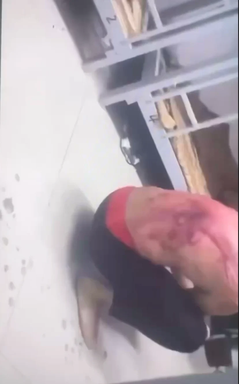 Scam Compound Victim