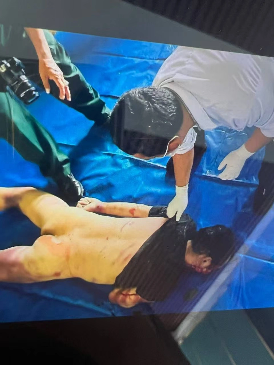 Scam Compound Victim